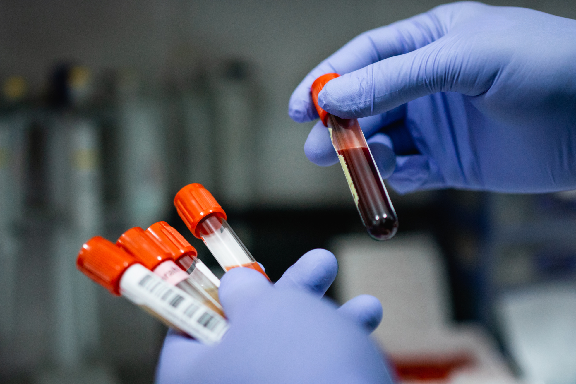 Gloved hands holding several bottles of blood ampoules